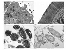 超薄切片+透射电镜（Bio-TEM）