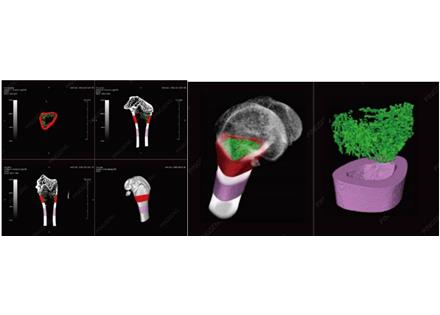 显微CT（Micro-CT）